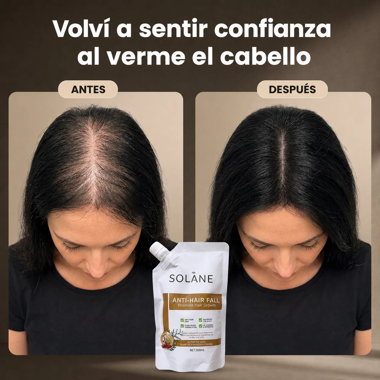 Solane® Shampoo Herbal Anticaída