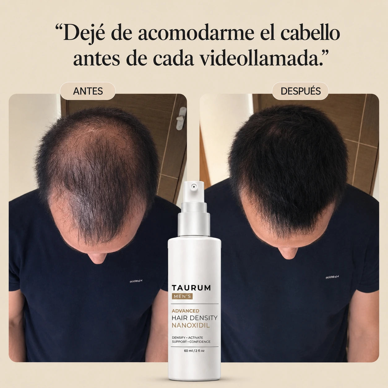Taurum® Spray Crecimiento capilar Nanoxidil 5%