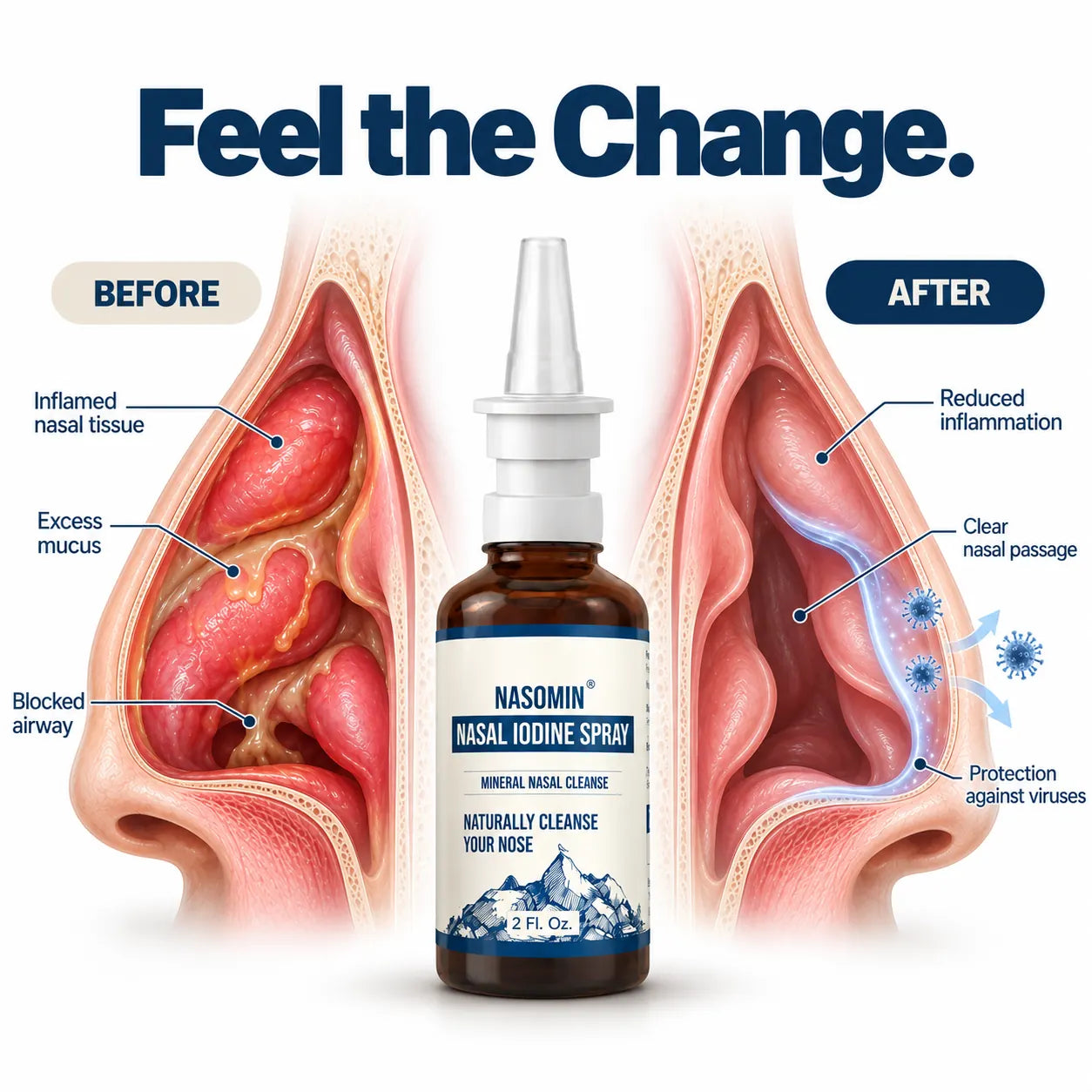Solane Iodine Nasal Spray™