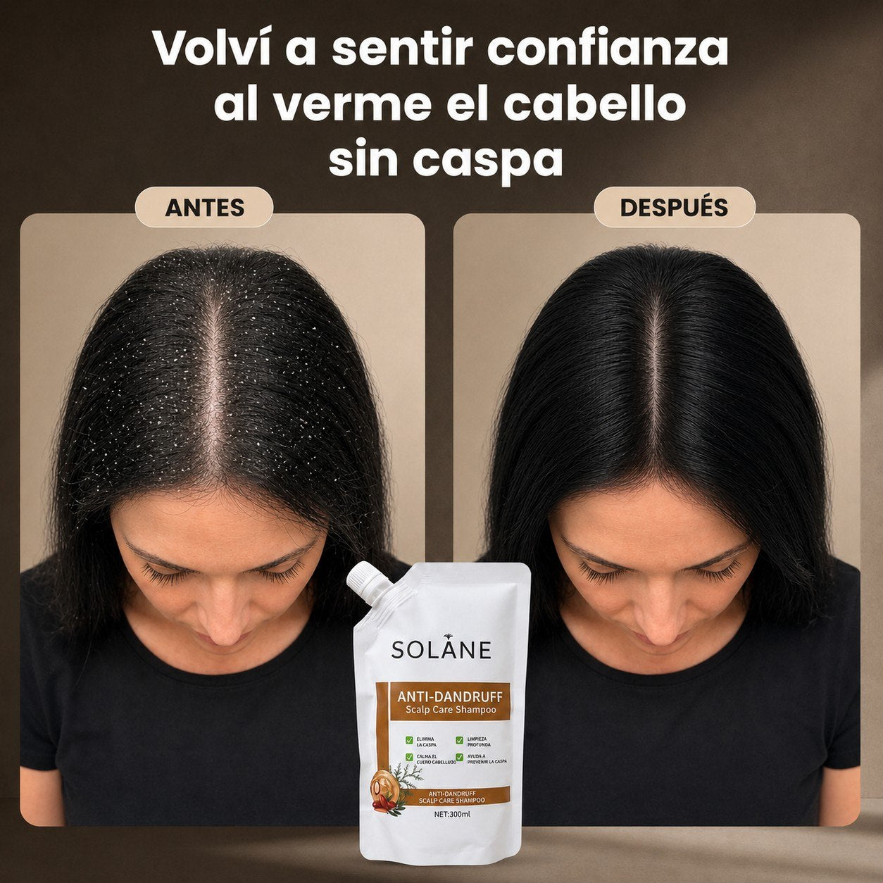 Solane® Shampoo Herbal Anticspa